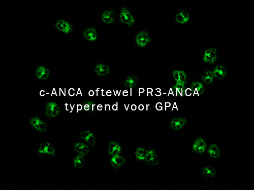C-ANCA=PR3-ANCA