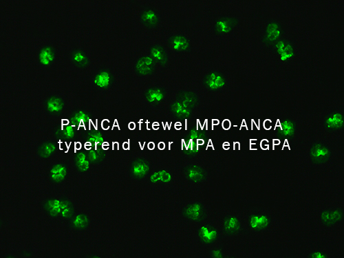 P-ANCA - MPO-ANCA