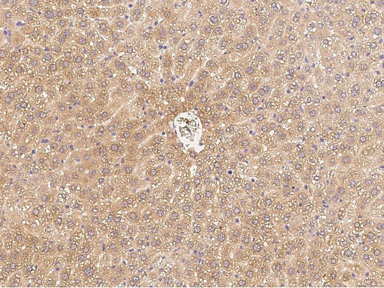 Anti C1Q antibody